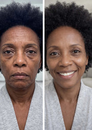 Walker Skin Protect® -  Target Dark Circles, Wrinkles & Fine Lines