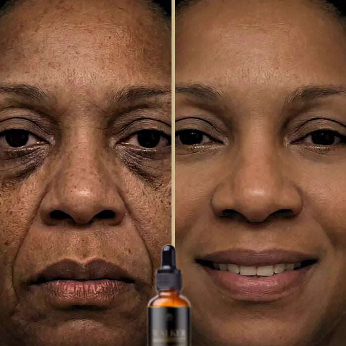 Walker Skin Protect® -  Target Dark Circles, Wrinkles & Fine Lines